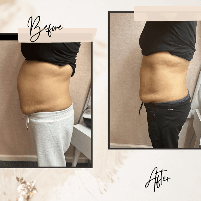 Buy 12 Sessions get 3 Free at Her Contour & Wellness, LLC in Antioch, CA